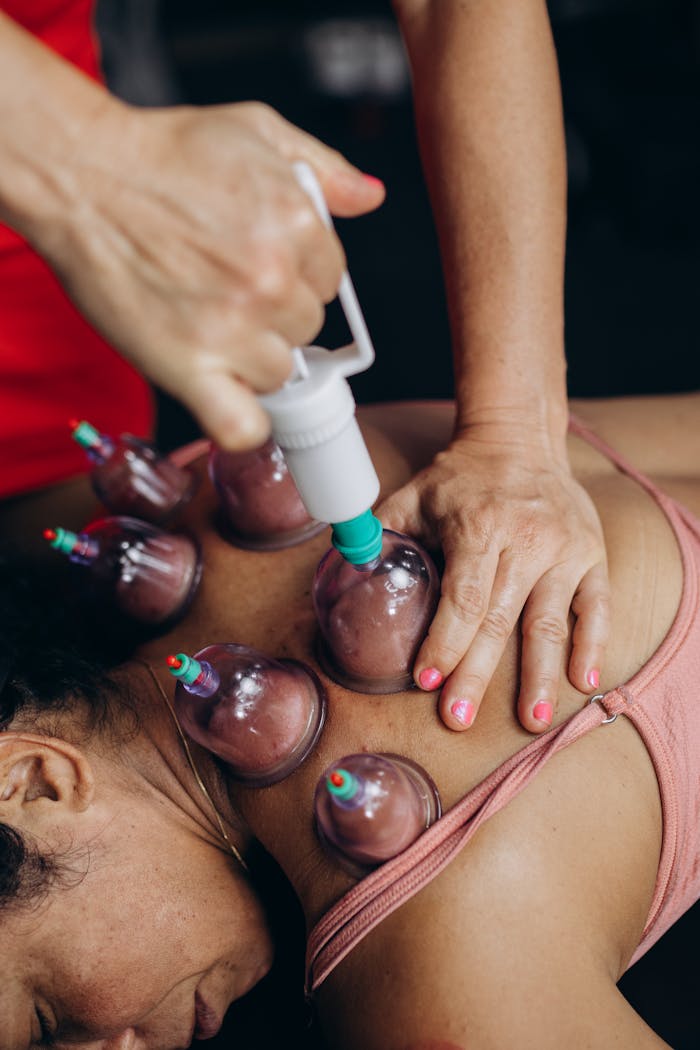 Close-up of cupping therapy on a woman's back, focusing on muscle recovery and relaxation.
